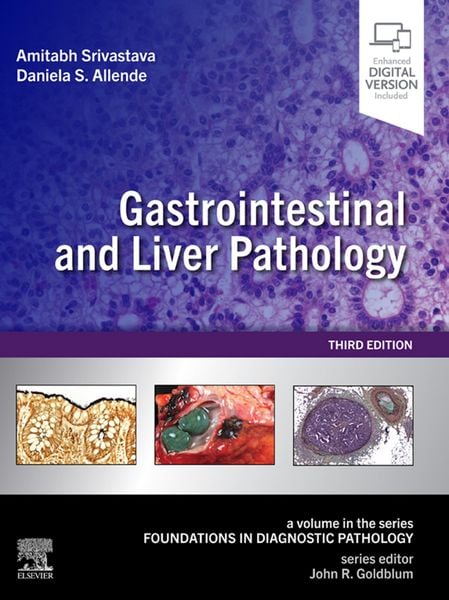 Produktbild: Gastrointestinal and Liver Pathology E-Book