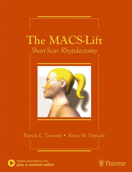 Produktbild: The MACS-Lift