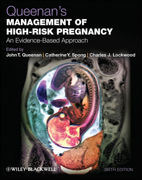 Produktbild: Queenan's Management of High-Risk Pregnancy
