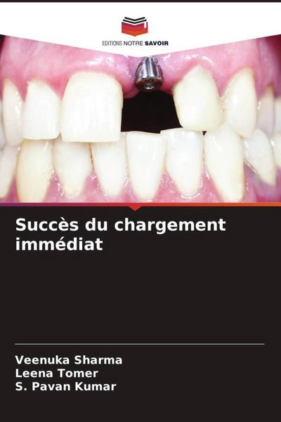 Produktbild: Succ&egrave;s du chargement imm&eacute;diat
