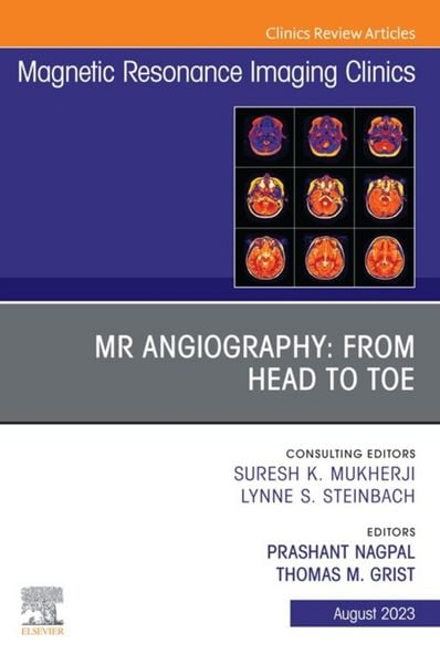 Produktbild: MR Angiography: From Head to Toe, An Issue of Magnetic Resonance Imaging Clinics of North America, E-Book