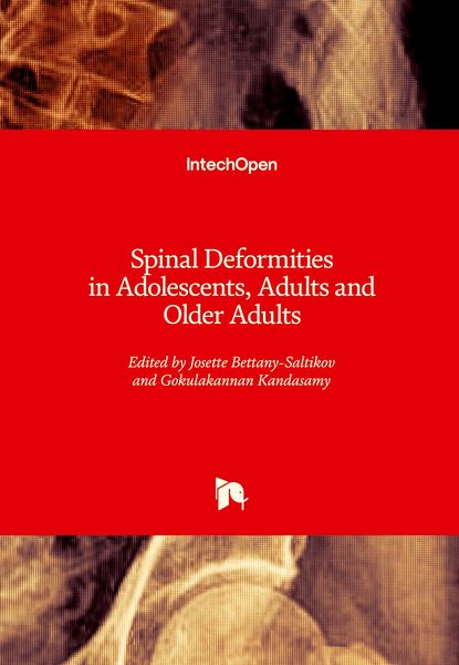 Produktbild: Spinal Deformities in Adolescents, Adults and Older Adults