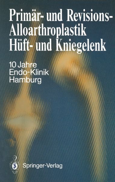 Primär- und Revisions-Alloarthroplastik Hüft- und Kniegelenk, Taschenbuch von , Springer Berlin, 9783642718335