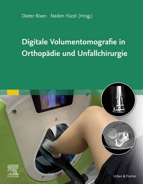 Produktbild: Digitale Volumentomografie in Orthop&auml;die und Unfallchirurgie