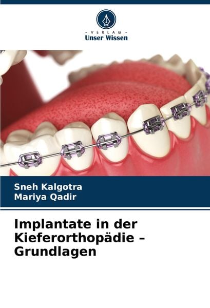 Produktbild: Implantate in der Kieferorthop&auml;die - Grundlagen