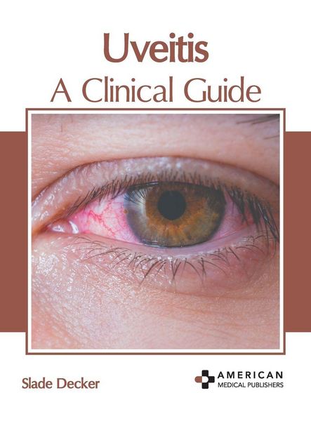Produktbild: Uveitis: A Clinical Guide