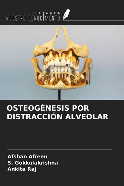 Produktbild: Osteog&eacute;nesis Por Distracci&oacute;n Alveolar