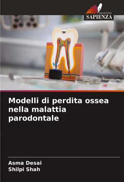 Produktbild: Modelli di perdita ossea nella malattia parodontale