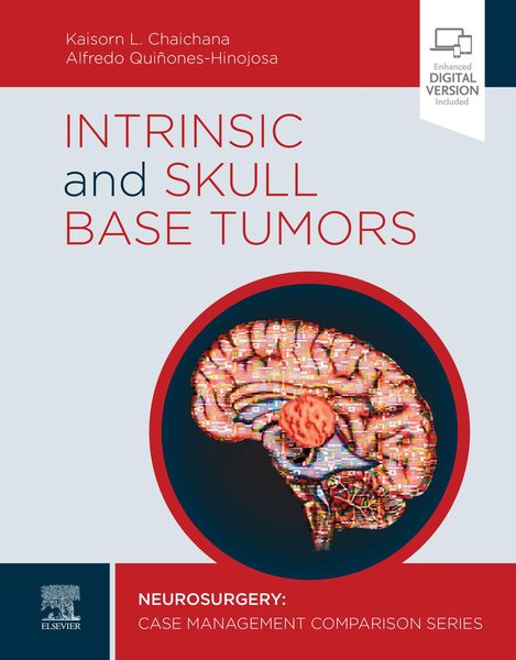 Produktbild: Intrinsic and Skull Base Tumors - E-Book