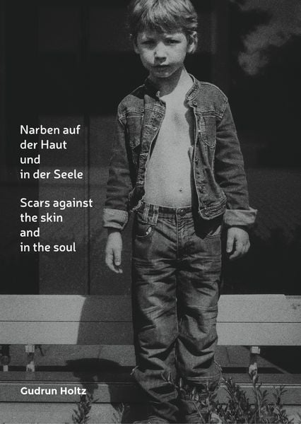 Produktbild: Narben auf der Haut und in der Seele