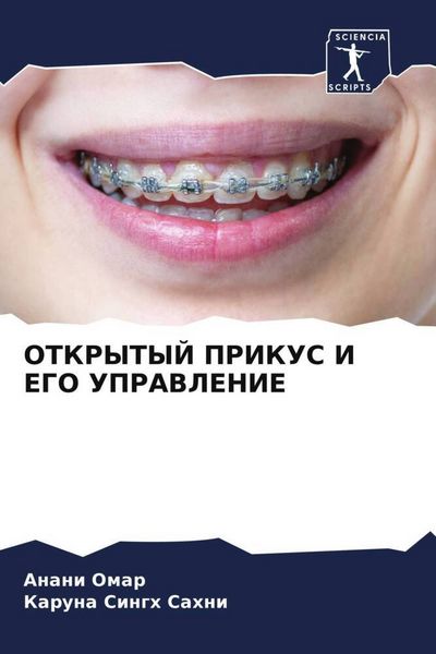 Produktbild: Otkrytyj Prikus I Ego Upravlenie