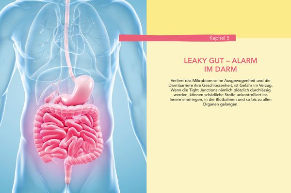 Produktbild: Das hilft bei Leaky Gut - Wie ein durchlässiger Darm uns krank macht und was wir dagegen tun können. Alles über Reizdarm & Co.
