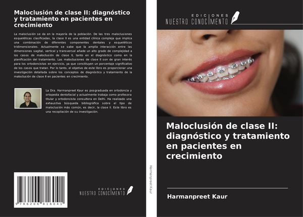 Produktbild: Maloclusi&oacute;n de clase II: diagn&oacute;stico y tratamiento en pacientes en crecimiento