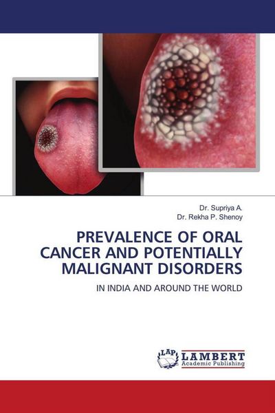 Produktbild: Prevalence Of Oral Cancer and Potentially Malignant Disorders