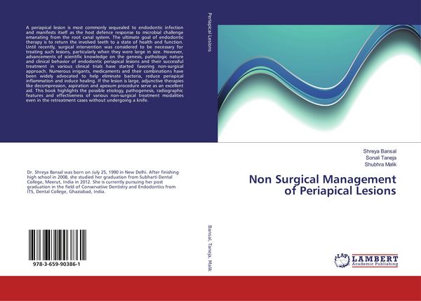Produktbild: Non Surgical Management of Periapical Lesions