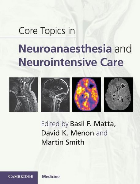 Produktbild: Core Topics in Neuroanaesthesia and Neurointensive Care