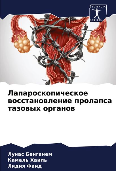 Produktbild: Laparoskopicheskoe wosstanowlenie prolapsa tazowyh organow