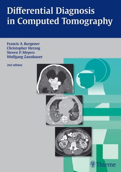 Produktbild: Differential Diagnosis in Computed Tomography