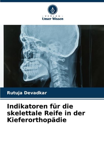 Indikatoren für die skelettale Reife in der Kieferorthopädie, Taschenbuch von Rutuja Devadkar, Verlag Unser Wissen, 9786208153175