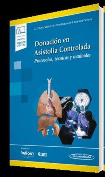 Produktbild: Donaci&oacute;n en Asistolia Controlada