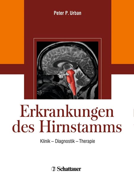 Produktbild: Erkrankungen des Hirnstamms