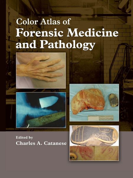 Produktbild: Catanese, C: Color Atlas of Forensic Medicine and Pathology
