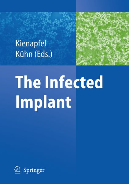 Produktbild: The Infected Implant