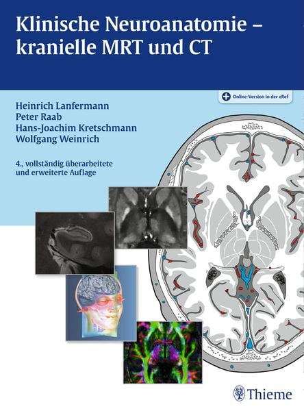 Klinische Neuroanatomie - kranielle MRT und CT, Set von Heinrich Lanfermann,Peter Raab,Hans-Joachim Kretschmann,Wolfgang Weinrich, Thieme,