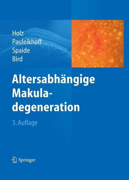 Produktbild: Altersabh&auml;ngige Makuladegeneration