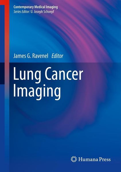 Produktbild: Lung Cancer Imaging