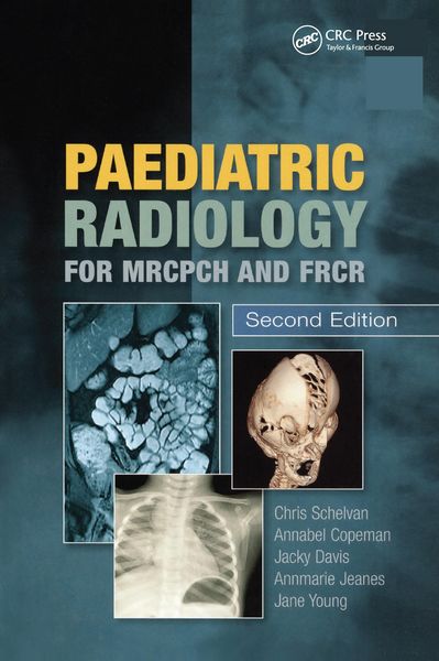 Produktbild: Paediatric Radiology for MRCPCH and FRCR, Second Edition