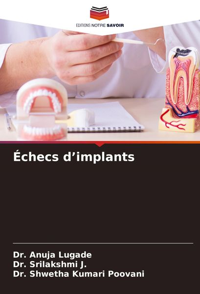 Produktbild: &Eacute;checs d'implants