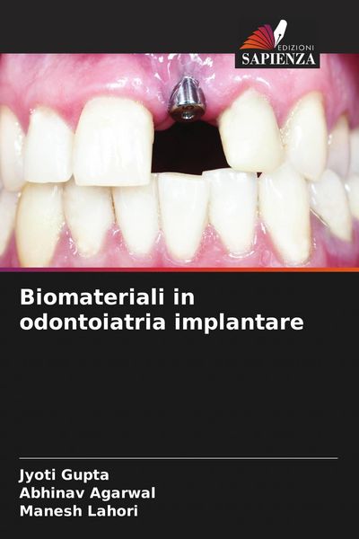 Produktbild: Biomateriali in odontoiatria implantare
