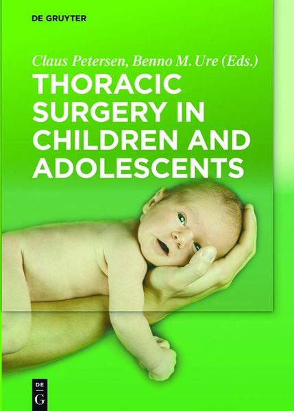 Produktbild: Thoracic Surgery in Children and Adolescents
