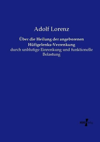 Produktbild: &Uuml;ber die Heilung der angeborenen H&uuml;ftgelenks-Verrenkung