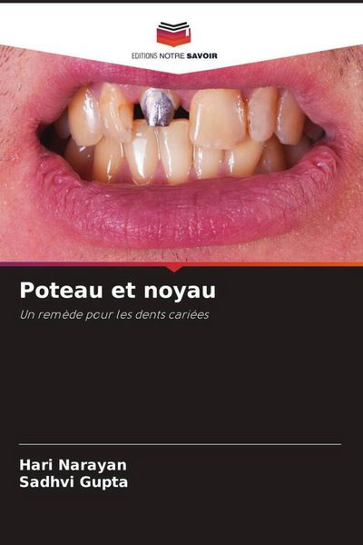 Produktbild: Poteau et noyau