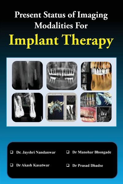 Produktbild: Present Status of Imaging Modalities For Implant Therapy