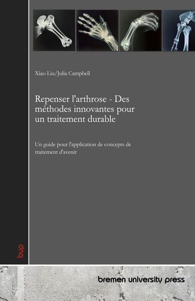Produktbild: Repenser l'arthrose - Des m&eacute;thodes innovantes pour un traitement durable