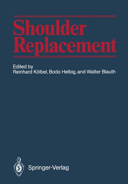 Produktbild: Shoulder Replacement