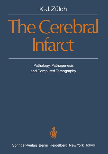 Produktbild: The Cerebral Infarct