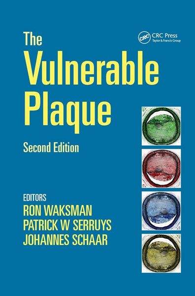 Produktbild: Handbook of the Vulnerable Plaque
