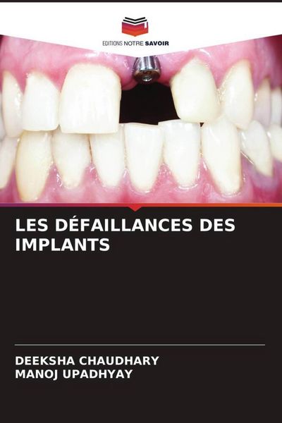 Produktbild: Les D&eacute;faillances des Implants