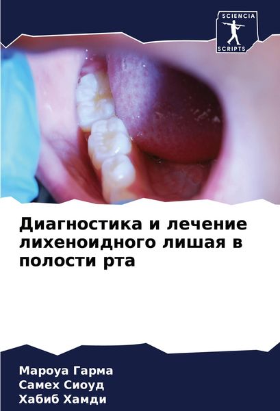 Produktbild: Diagnostika i lechenie lihenoidnogo lishaq w polosti rta