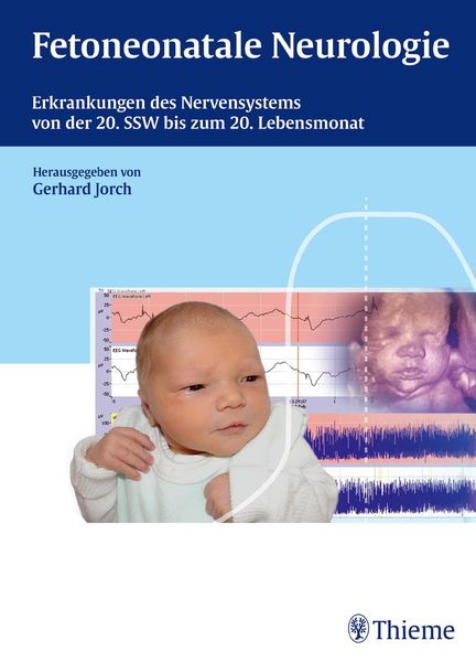 Produktbild: Fetoneonatale Neurologie