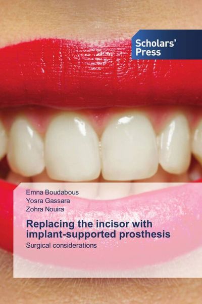 Produktbild: Replacing the incisor with implant-supported prosthesis