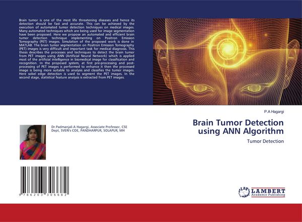 Produktbild: Brain Tumor Detection using ANN Algorithm