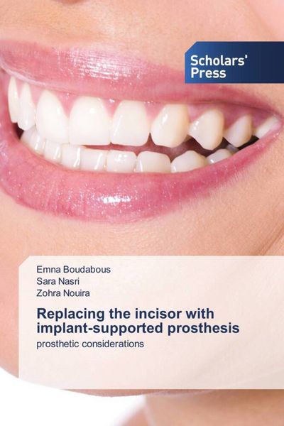 Produktbild: Replacing the incisor with implant-supported prosthesis
