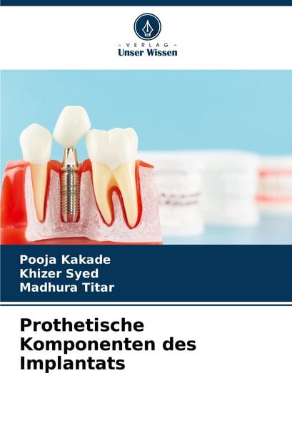 Prothetische Komponenten des Implantats, Taschenbuch von Pooja Kakade , Khizer Syed , Madhura Titar, Verlag Unser Wissen, 9786208501501
