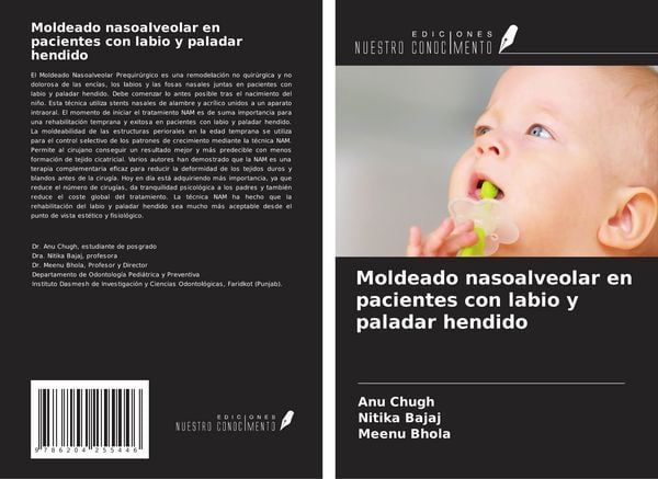 Produktbild: Moldeado nasoalveolar en pacientes con labio y paladar hendido