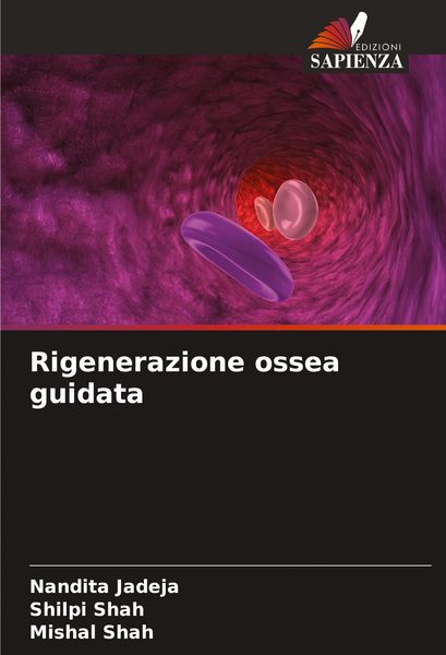 Produktbild: Rigenerazione ossea guidata